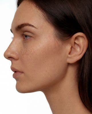 a close up of a woman with freckles on her face