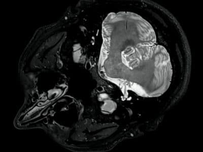 a mri image of a man's head
