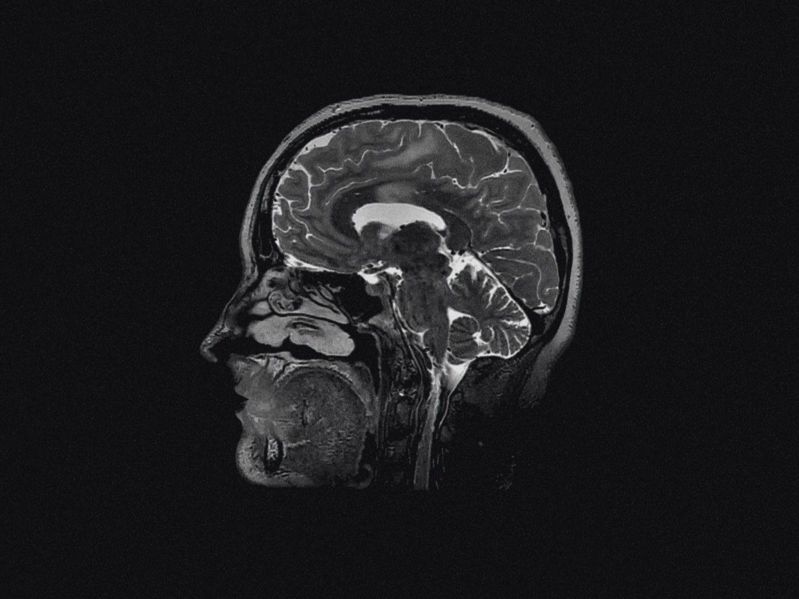a black and white photo of a human head