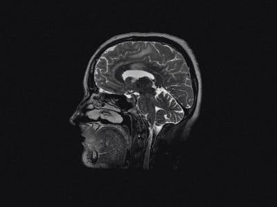 a black and white photo of a human head