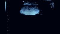 a blurry image of a vase in a dark room