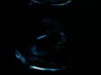 a blurry photo of a vase in the dark