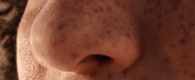 a close up of a person's nose and nose