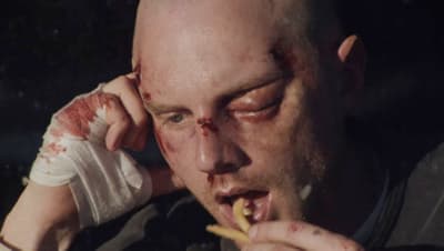 a man with blood on his face eating a banana