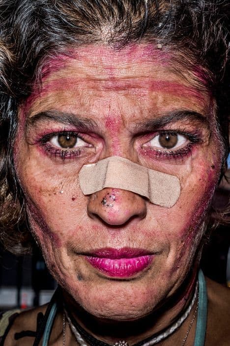 a woman with a piece of tape on her nose