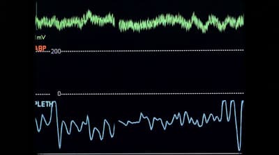 a black background with a line graph and a black background with a line graph