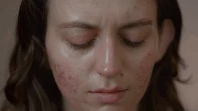 a woman with freckles on her face looking down