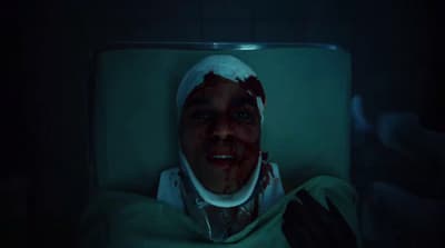 a man in a hospital bed with blood on his face