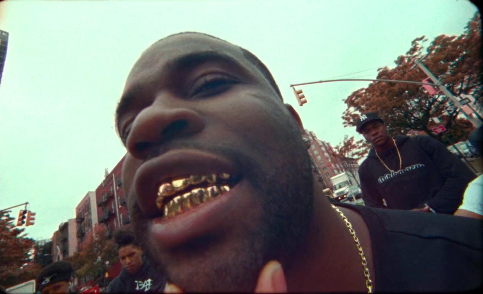 a man with a gold grill on his mouth