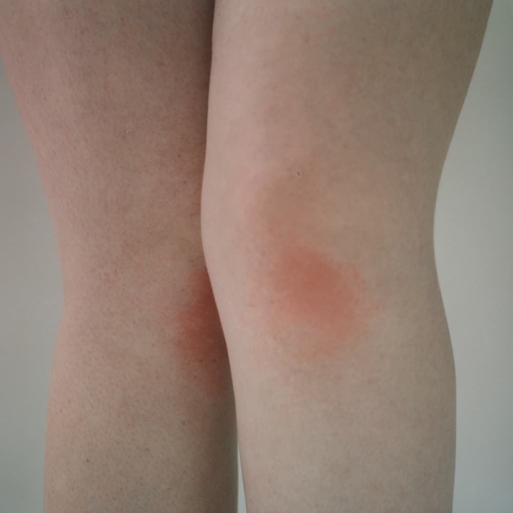 a close up of a person's legs with a red spot on it