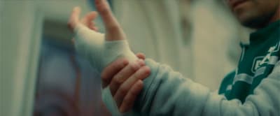 a man with a cast on his arm